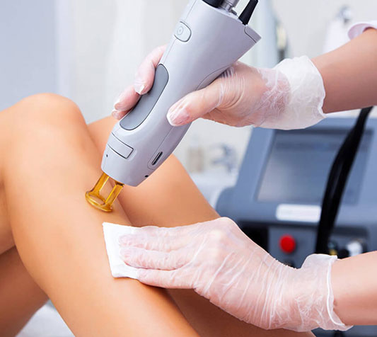 Professional laser hair removal treatment being performed on a client's leg